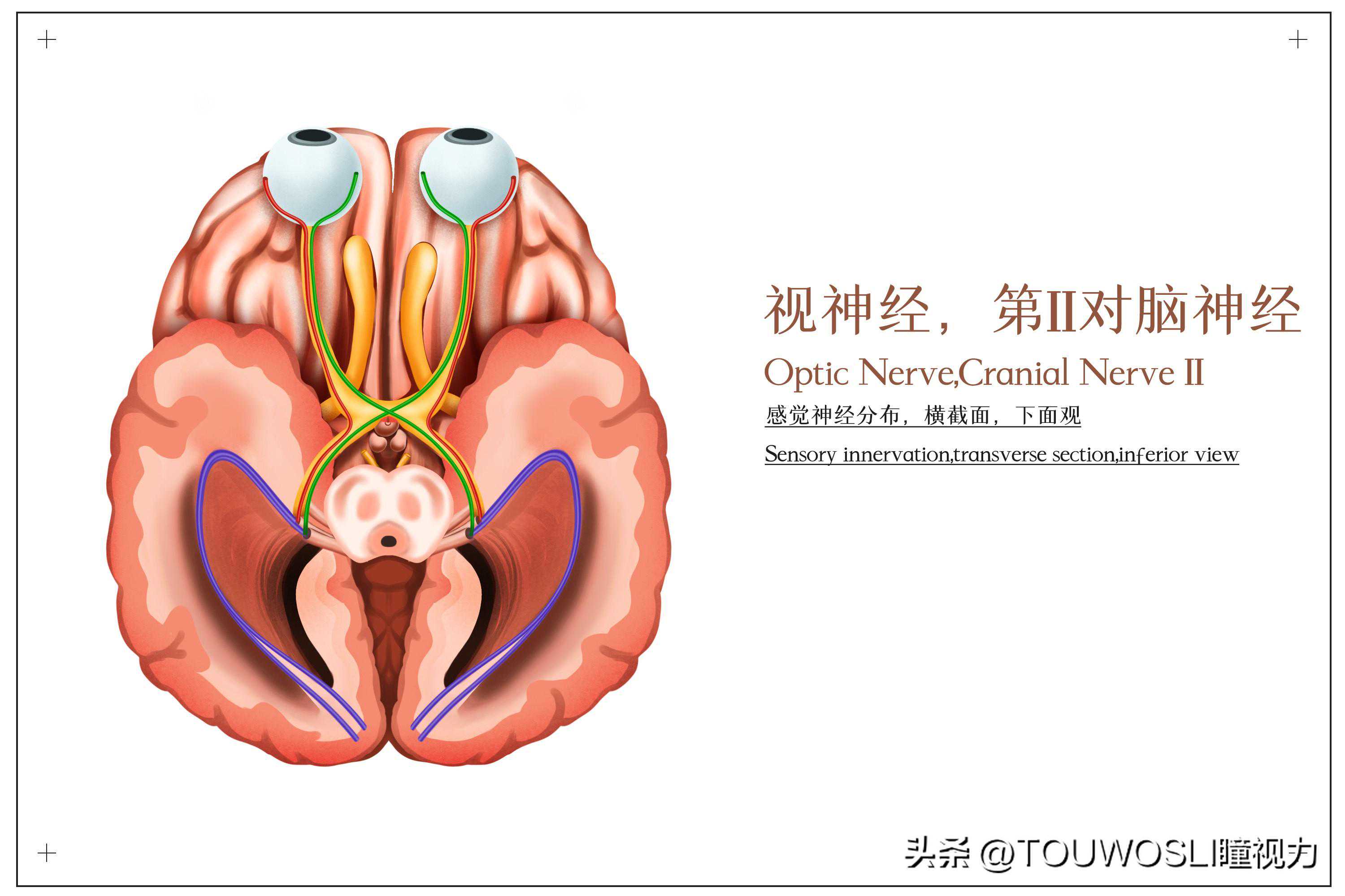 视神经炎(opticneuritis，ON)不容小觑！如何做好防范？